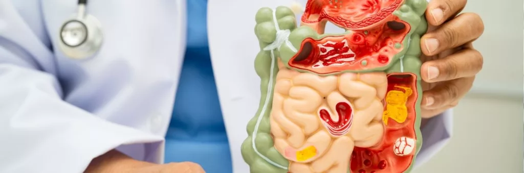 Solutions naturelles pour renforcer la flore intestinale et améliorer la digestion