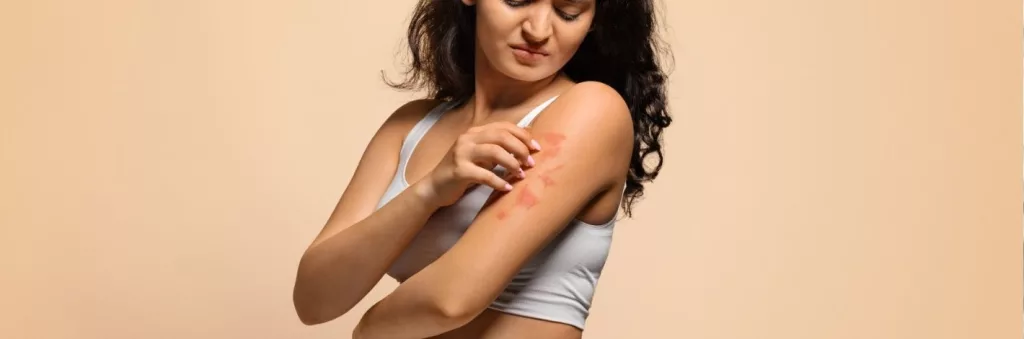 Solutions naturelles pour apaiser les peaux sujettes à l’eczéma et favoriser le confort cutané